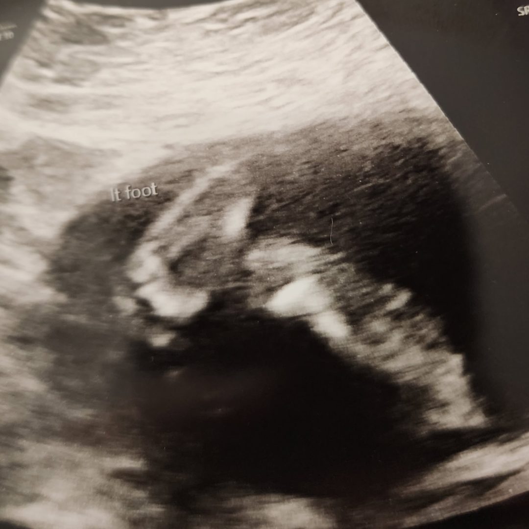Photo shared by Adrianna for their Babylist baby registry.