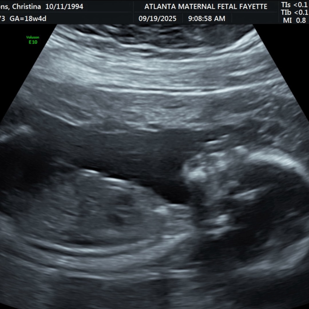 Photo shared by Christina for their Babylist baby registry.