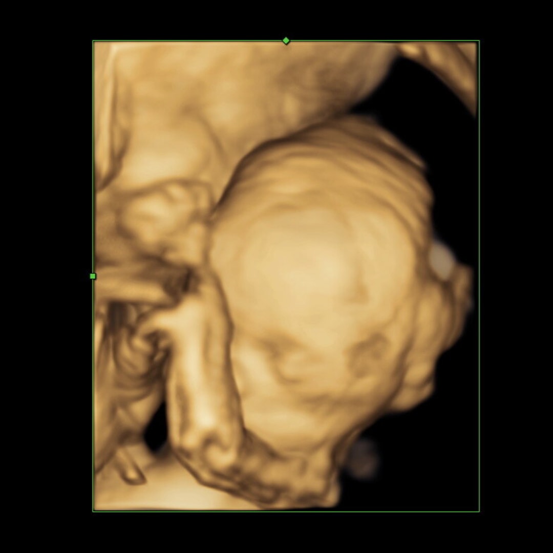 Photo shared by Angelika for their Babylist baby registry.