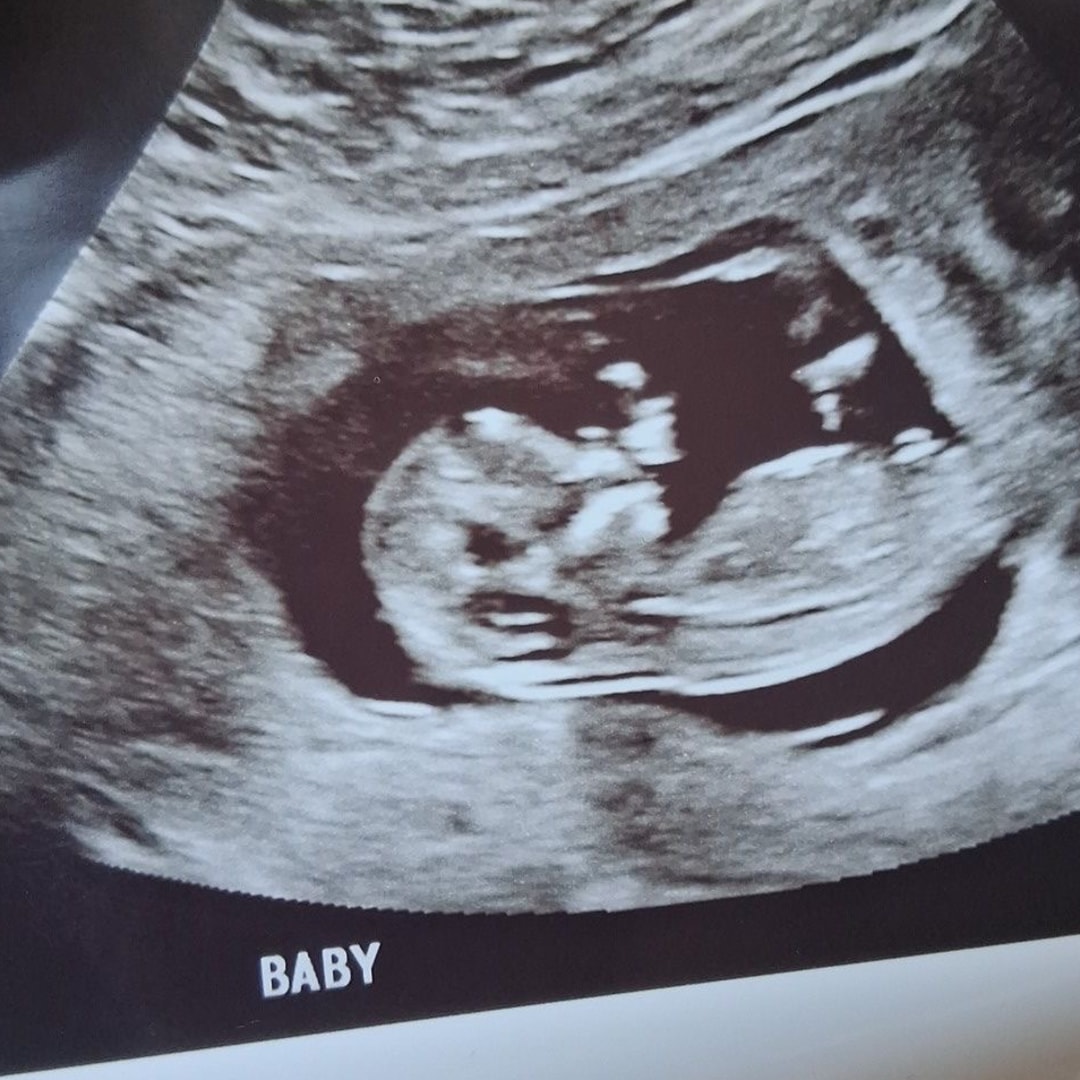 Photo shared by Audrianna for their Babylist baby registry.