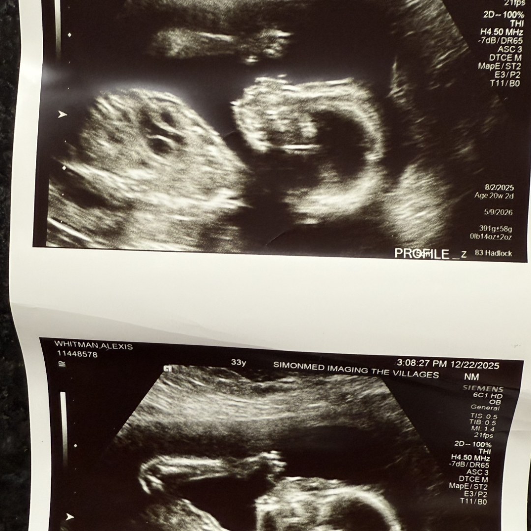 Photo shared by Alexis for their Babylist baby registry.