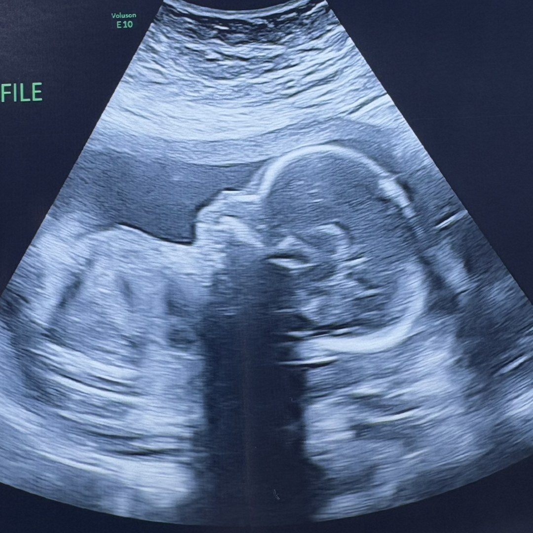 Photo shared by Courtney for their Babylist baby registry.