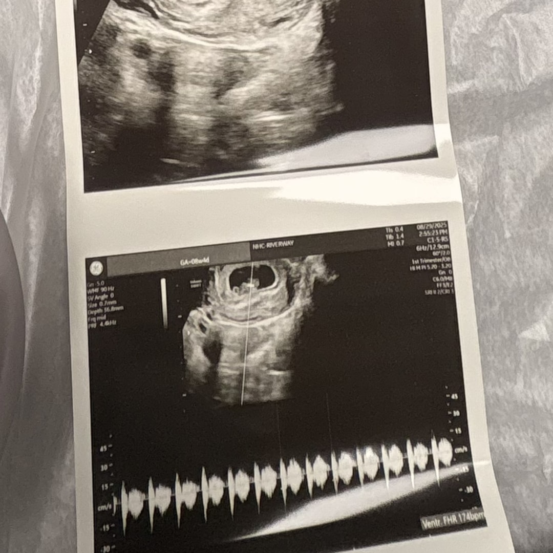 Photo shared by Rae’Chell for their Babylist baby registry.