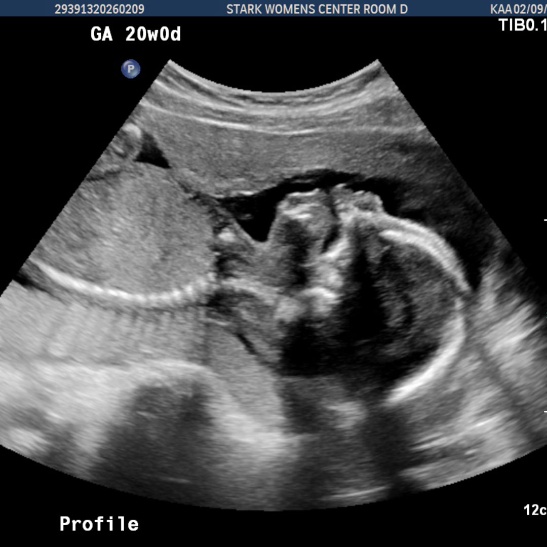 Photo shared by Ella for their Babylist baby registry.