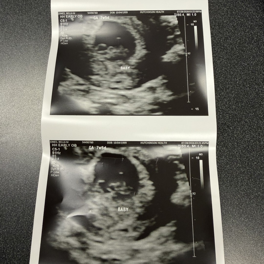 Photo shared by Bella for their Babylist baby registry.
