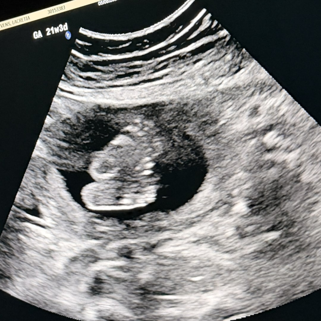 Photo shared by Inez for their Babylist baby registry.
