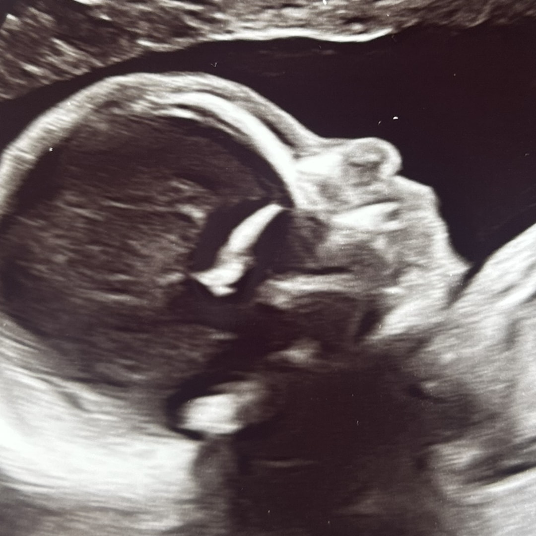 Photo shared by Chelsea for their Babylist baby registry.