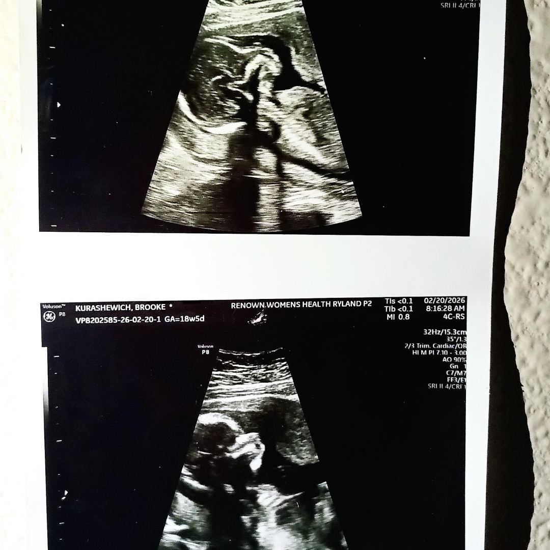 Photo shared by Brooke for their Babylist baby registry.