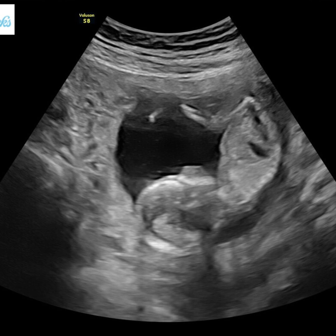 Photo shared by Jana for their Babylist baby registry.