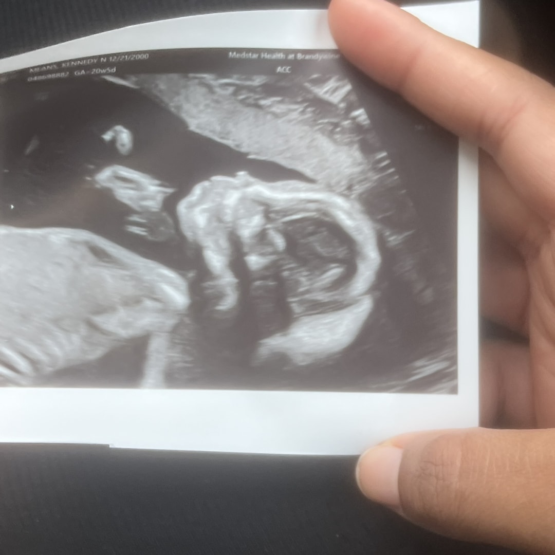Photo shared by Kennedy for their Babylist baby registry.