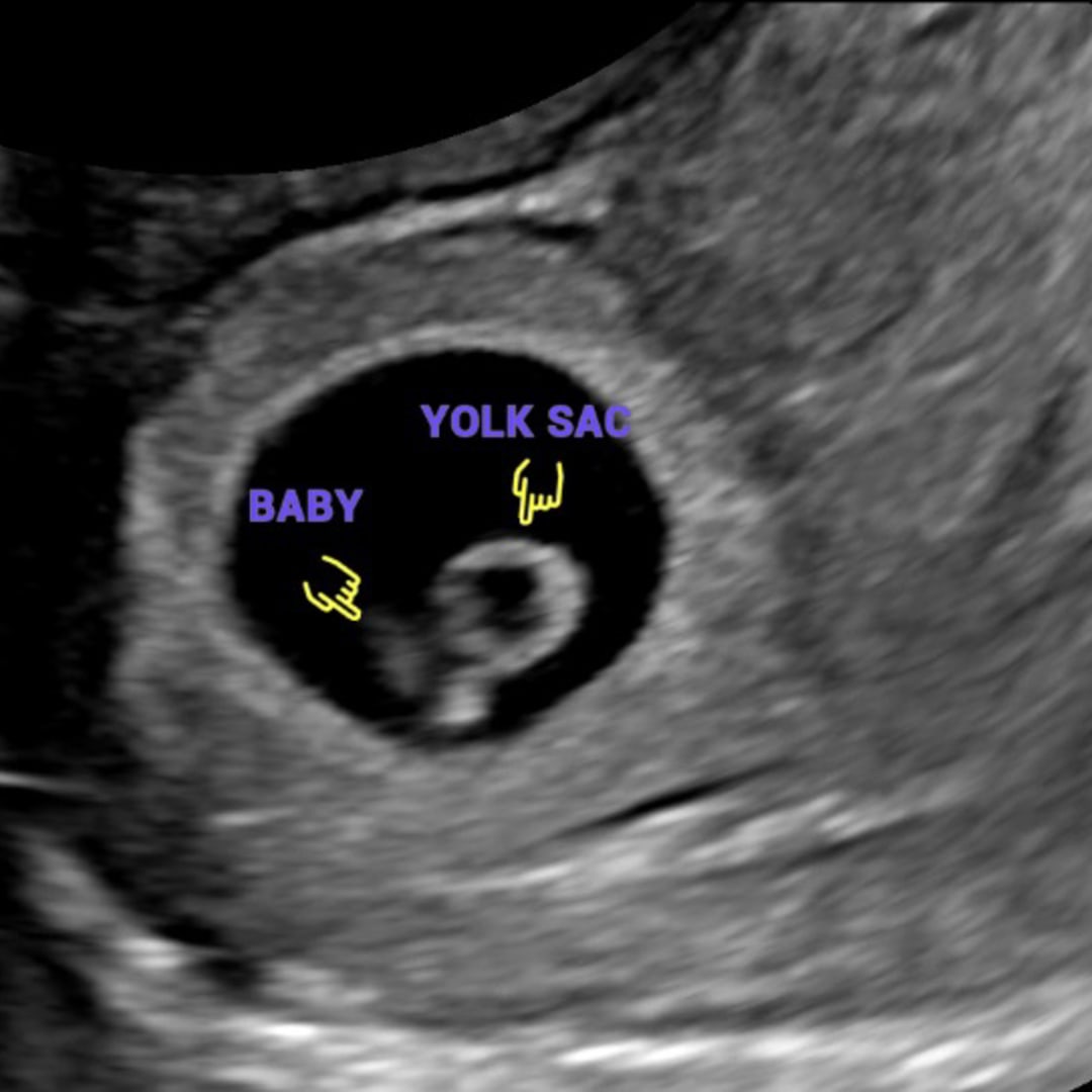 Photo shared by Zenda for their Babylist baby registry.