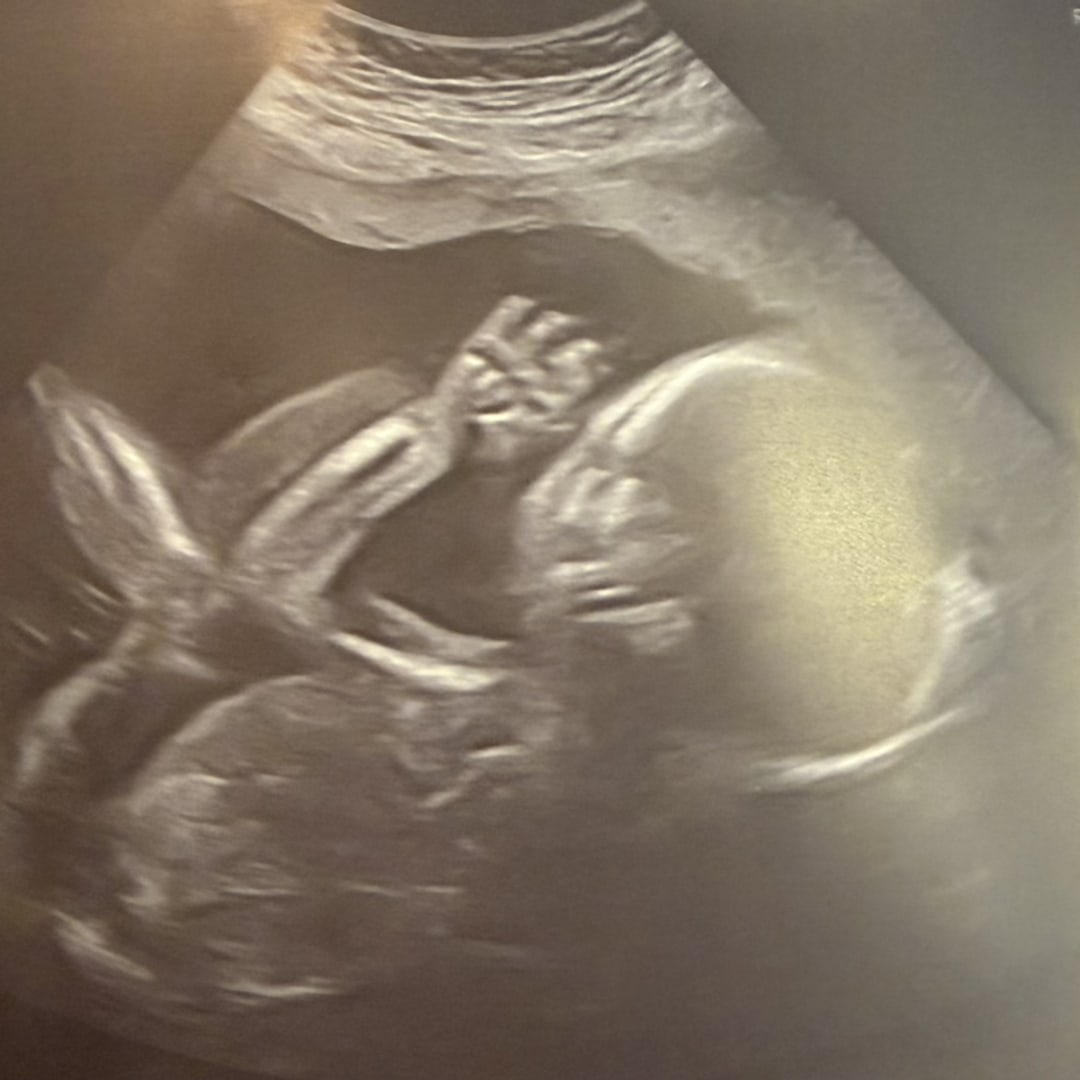 Photo shared by Katie for their Babylist baby registry.
