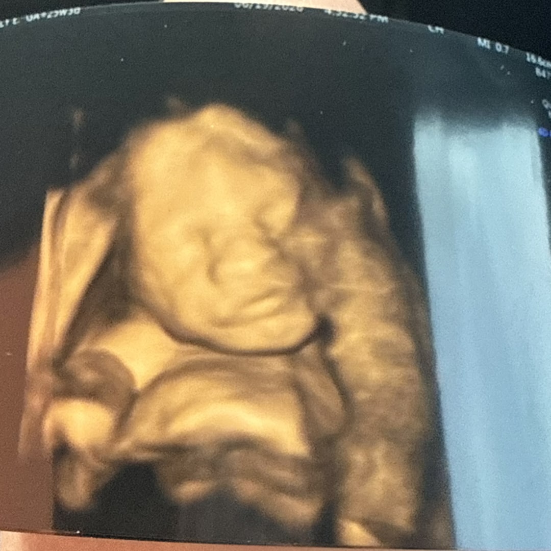 Photo shared by Molly for their Babylist baby registry.
