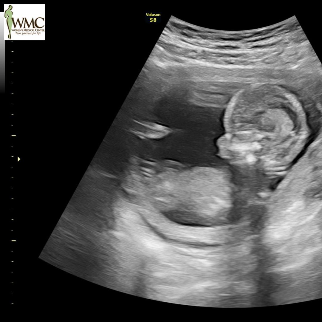 Photo shared by Callie for their Babylist baby registry.