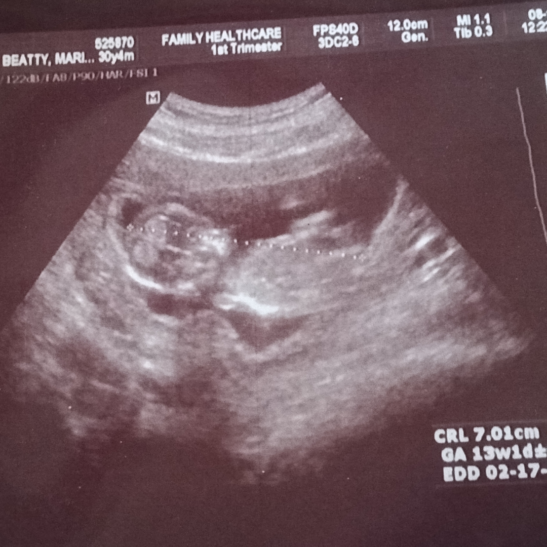 Photo shared by Marissa for their Babylist baby registry.