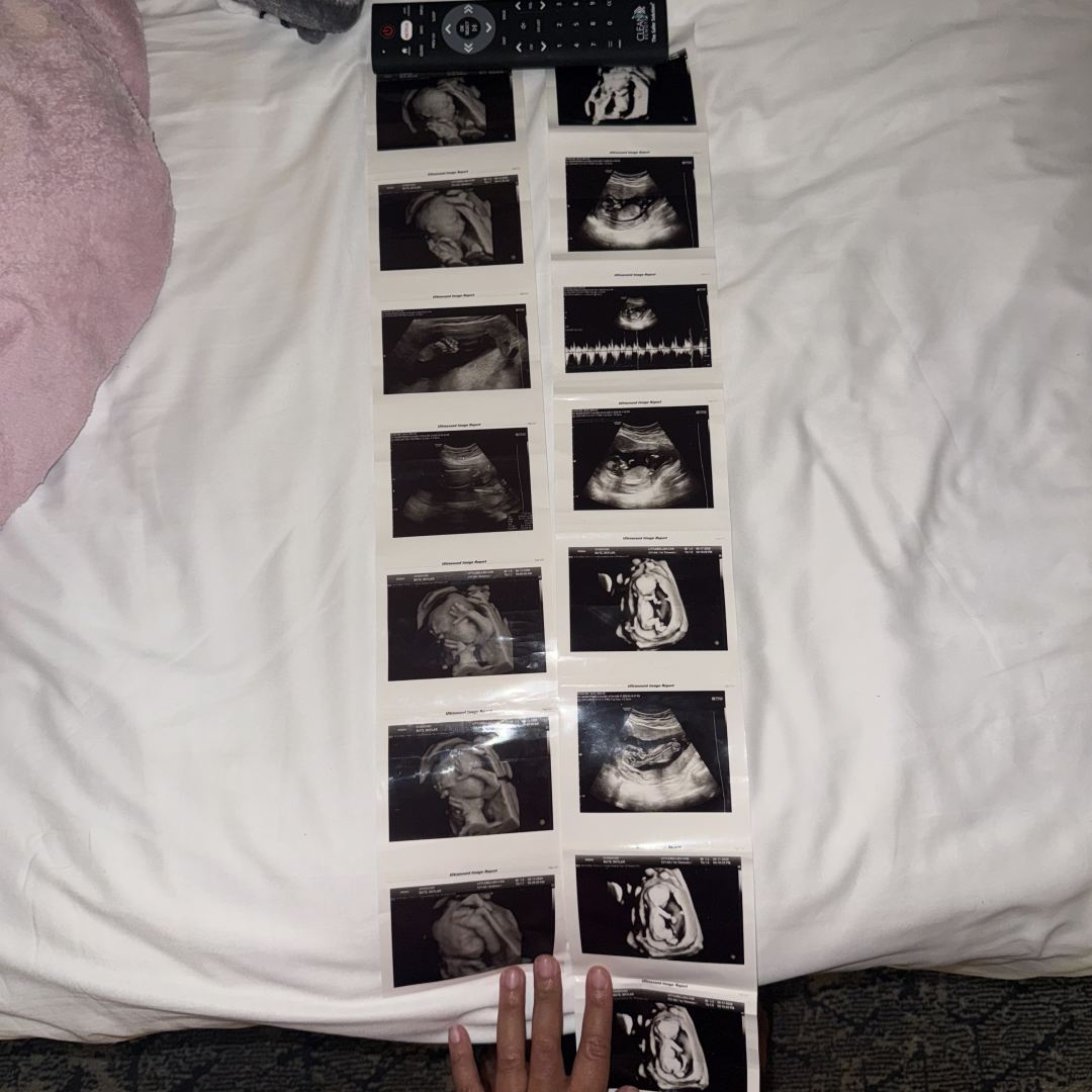 Photo shared by Skylar for their Babylist baby registry.