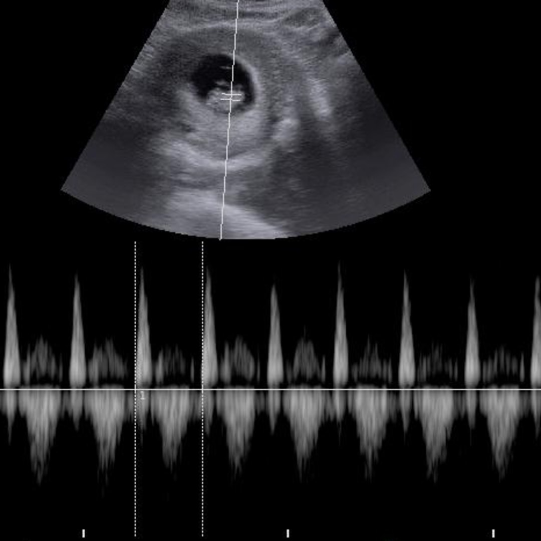 Photo shared by Mele for their Babylist baby registry.