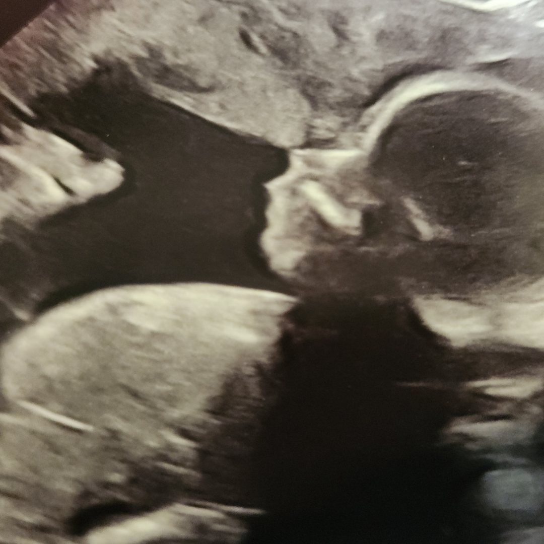 Photo shared by AuraBellah for their Babylist baby registry.