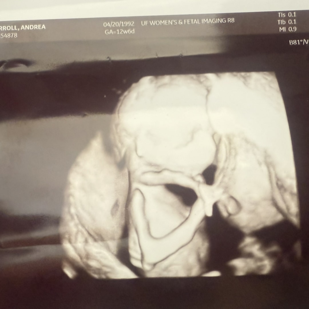 Photo shared by Andrea for their Babylist baby registry.
