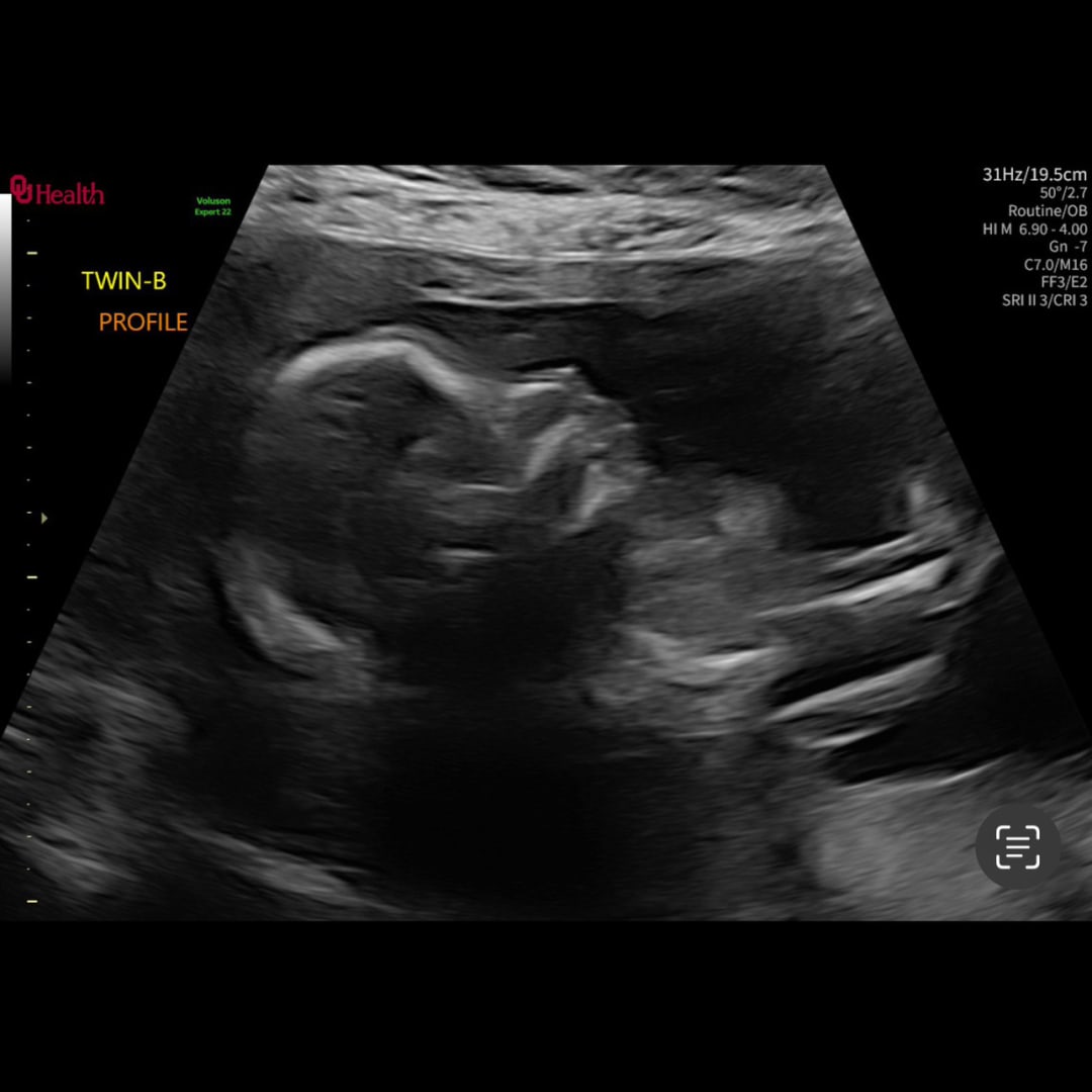 Photo shared by Teagan for their Babylist baby registry.