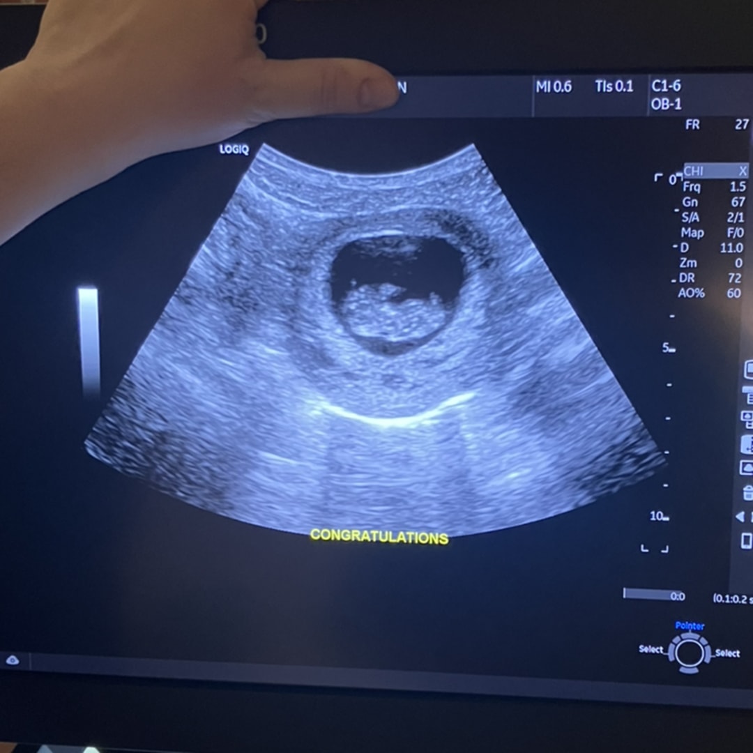 Photo shared by Kiersten for their Babylist baby registry.