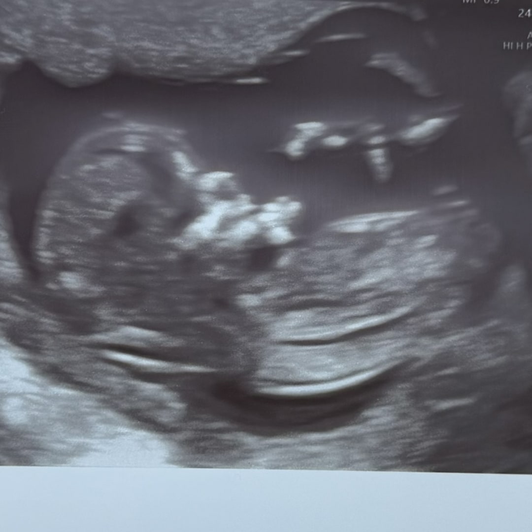 Photo shared by Alexandra for their Babylist baby registry.