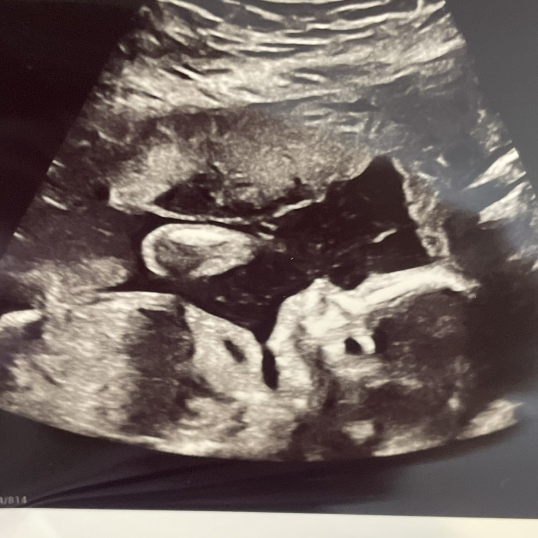 Photo shared by Danielle for their Babylist baby registry.