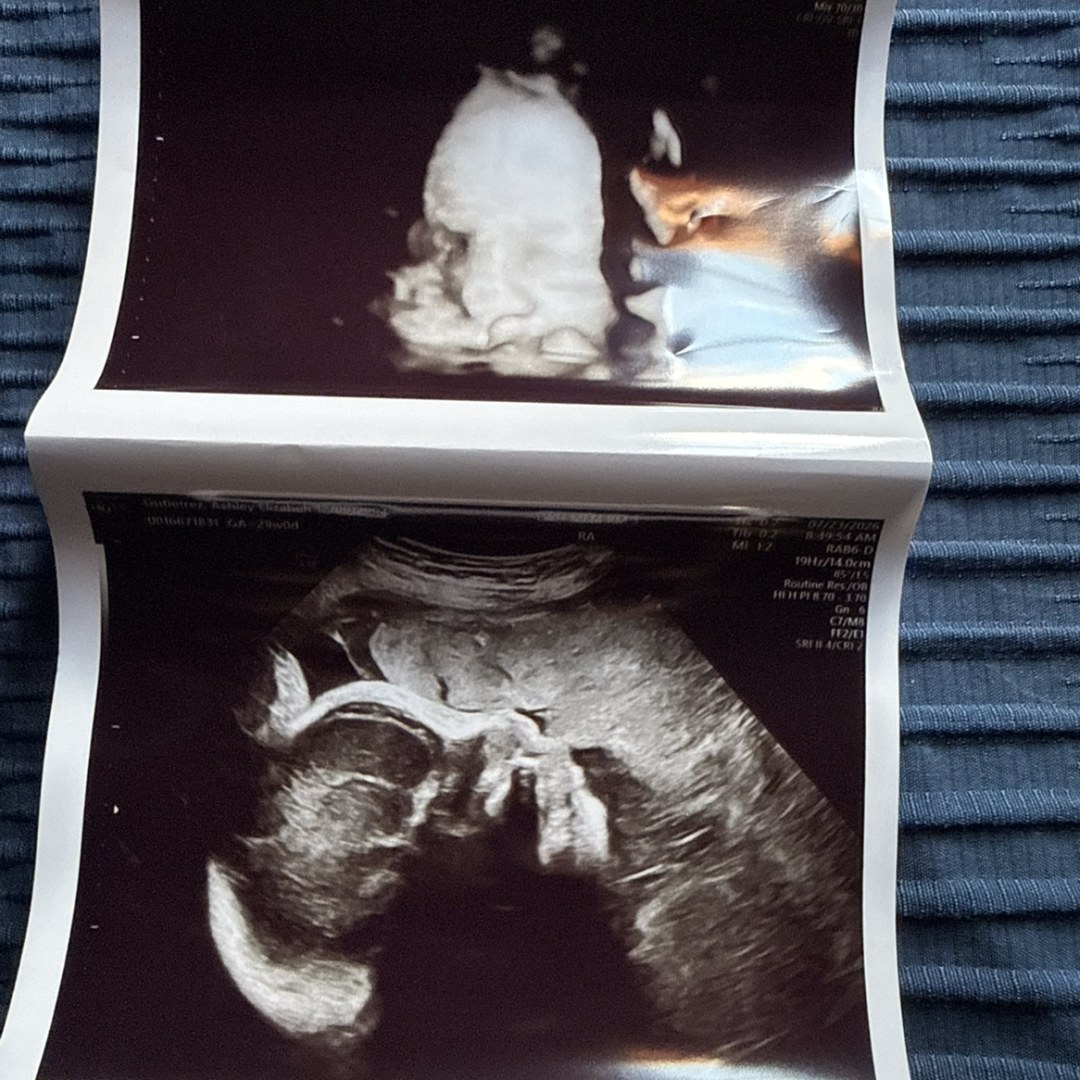 Photo shared by Ashley for their Babylist baby registry.
