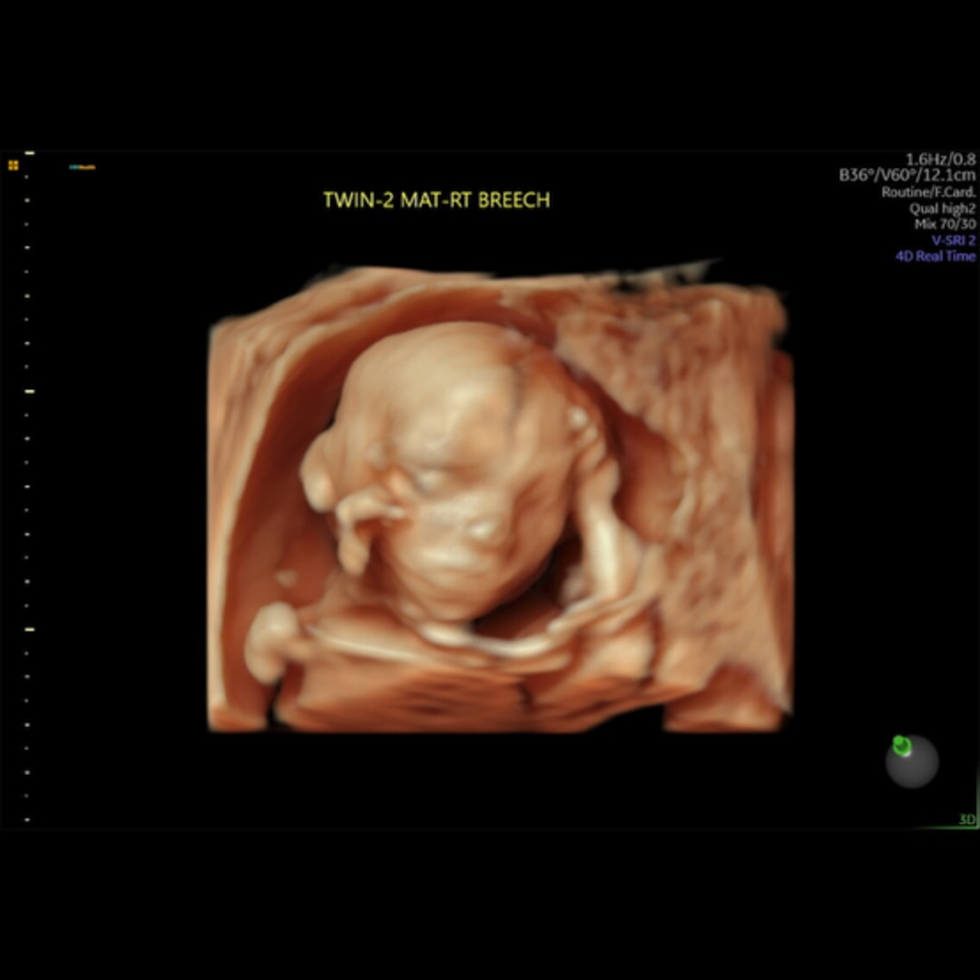 Photo shared by Heaven for their Babylist baby registry.