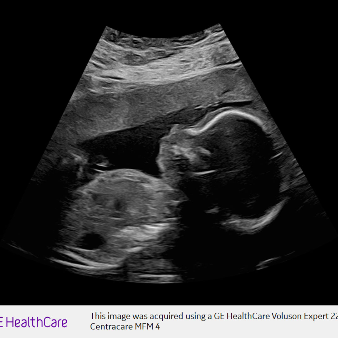 Photo shared by Whitney for their Babylist baby registry.