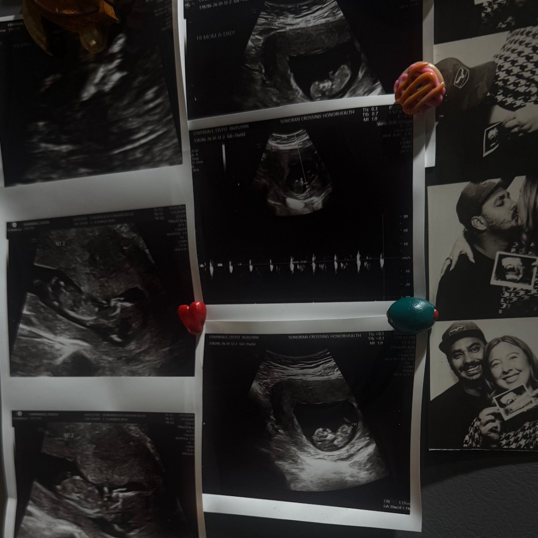 Photo shared by Cc & Austin’s for their Babylist baby registry.