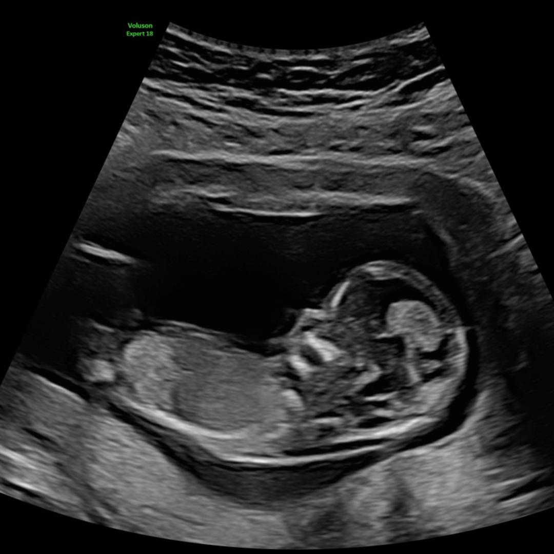 Photo shared by Allie for their Babylist baby registry.