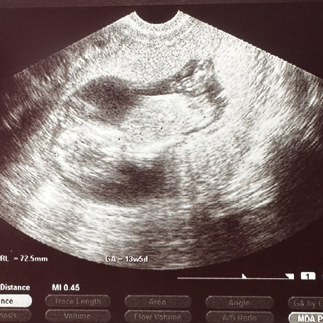 Photo shared by Rachel for their Babylist baby registry.