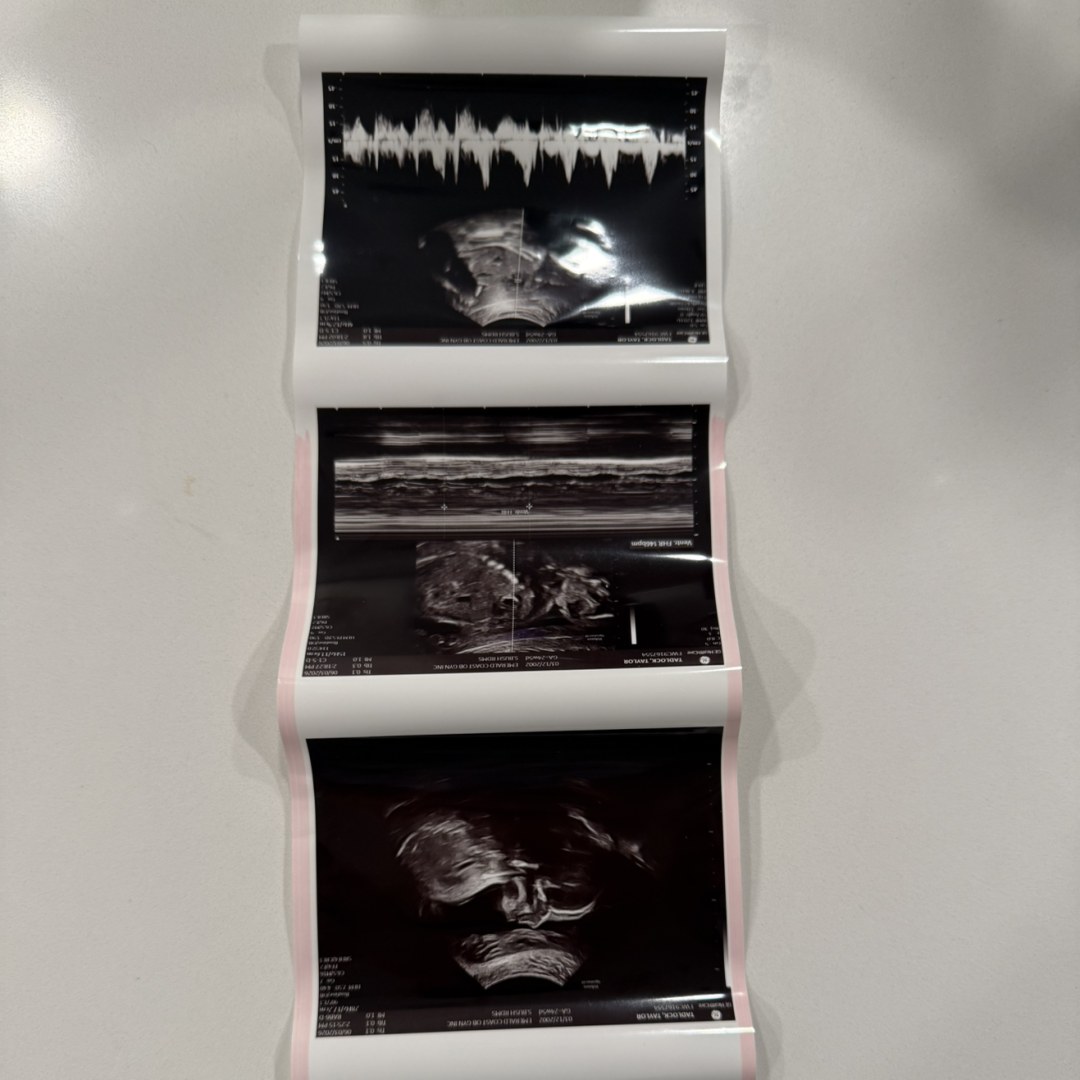 Photo shared by Logan for their Babylist baby registry.
