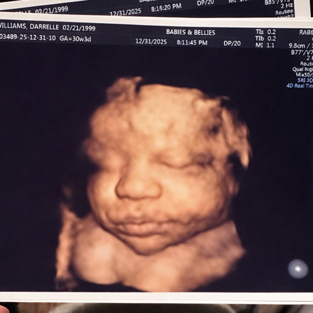 Photo shared by Darrelle for their Babylist baby registry.