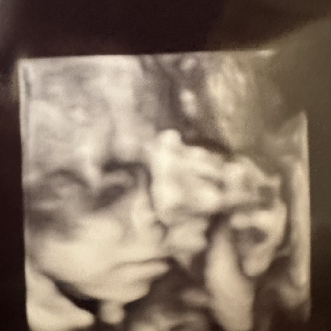 Photo shared by Jenna for their Babylist baby registry.