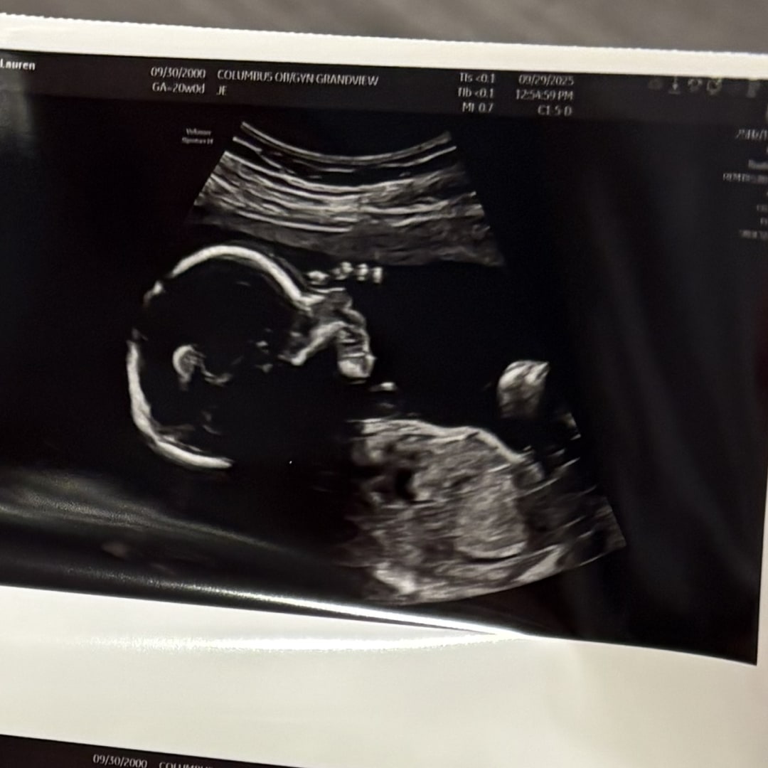 Photo shared by Lauren for their Babylist baby registry.