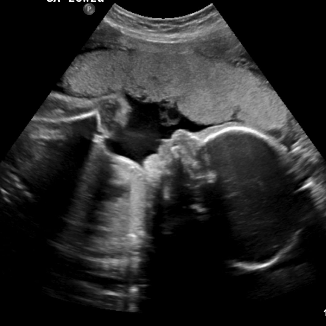 Photo shared by Josie for their Babylist baby registry.