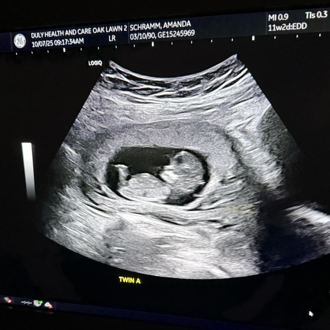 Photo shared by Amanda for their Babylist baby registry.