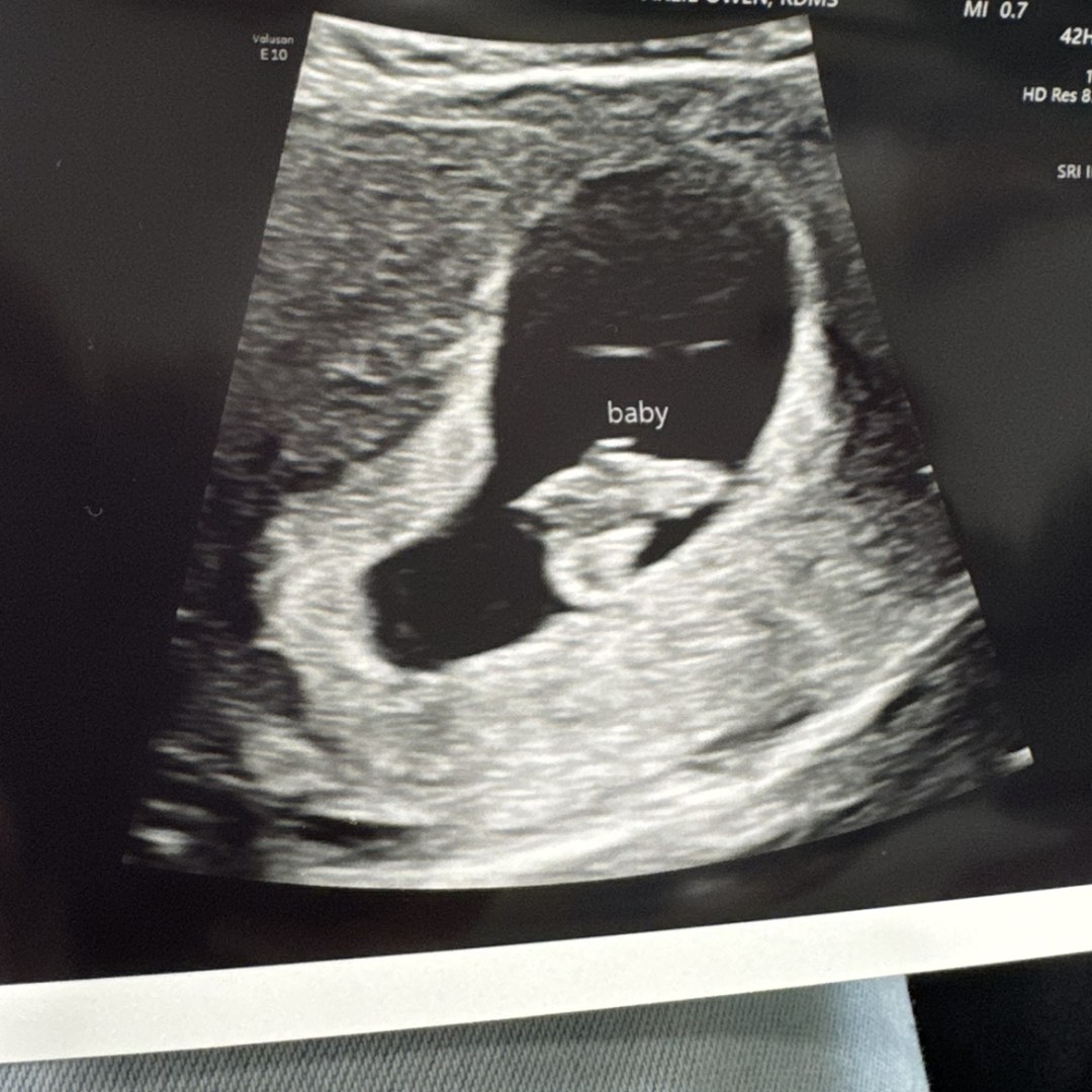 Photo shared by Breanna for their Babylist baby registry.