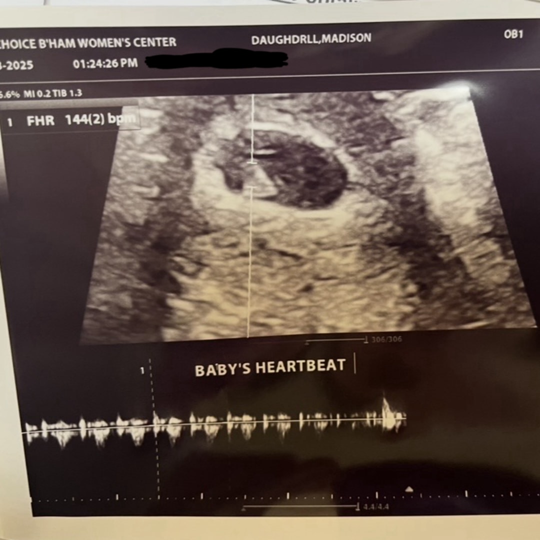 Photo shared by Madison for their Babylist baby registry.