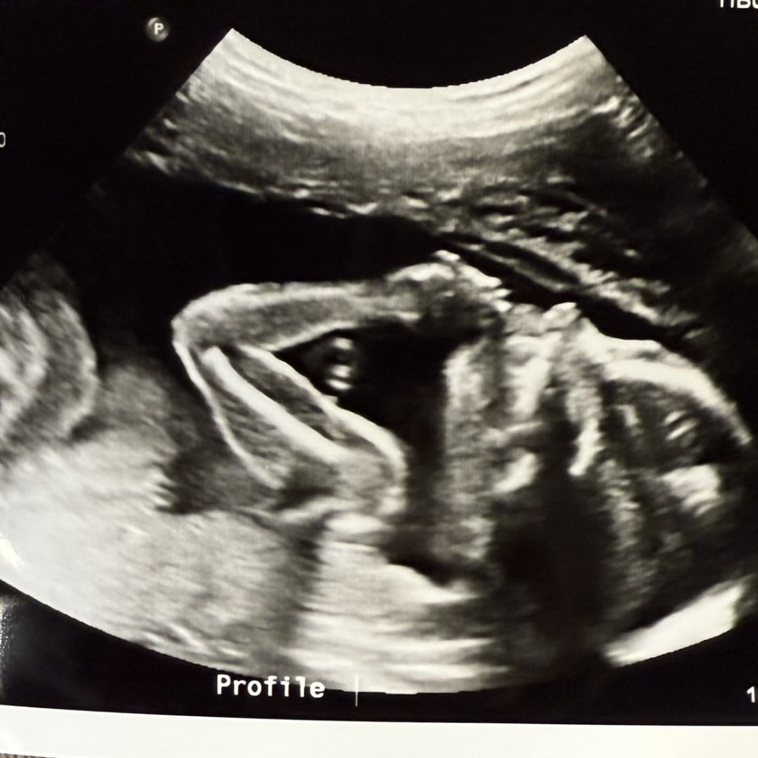 Photo shared by Adeline for their Babylist baby registry.