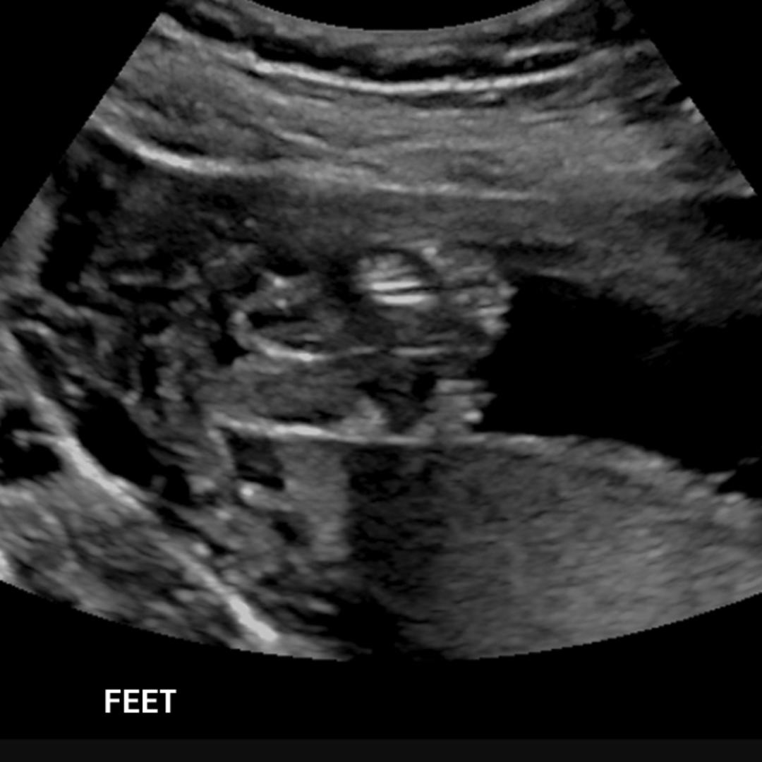 Photo shared by Clairae for their Babylist baby registry.