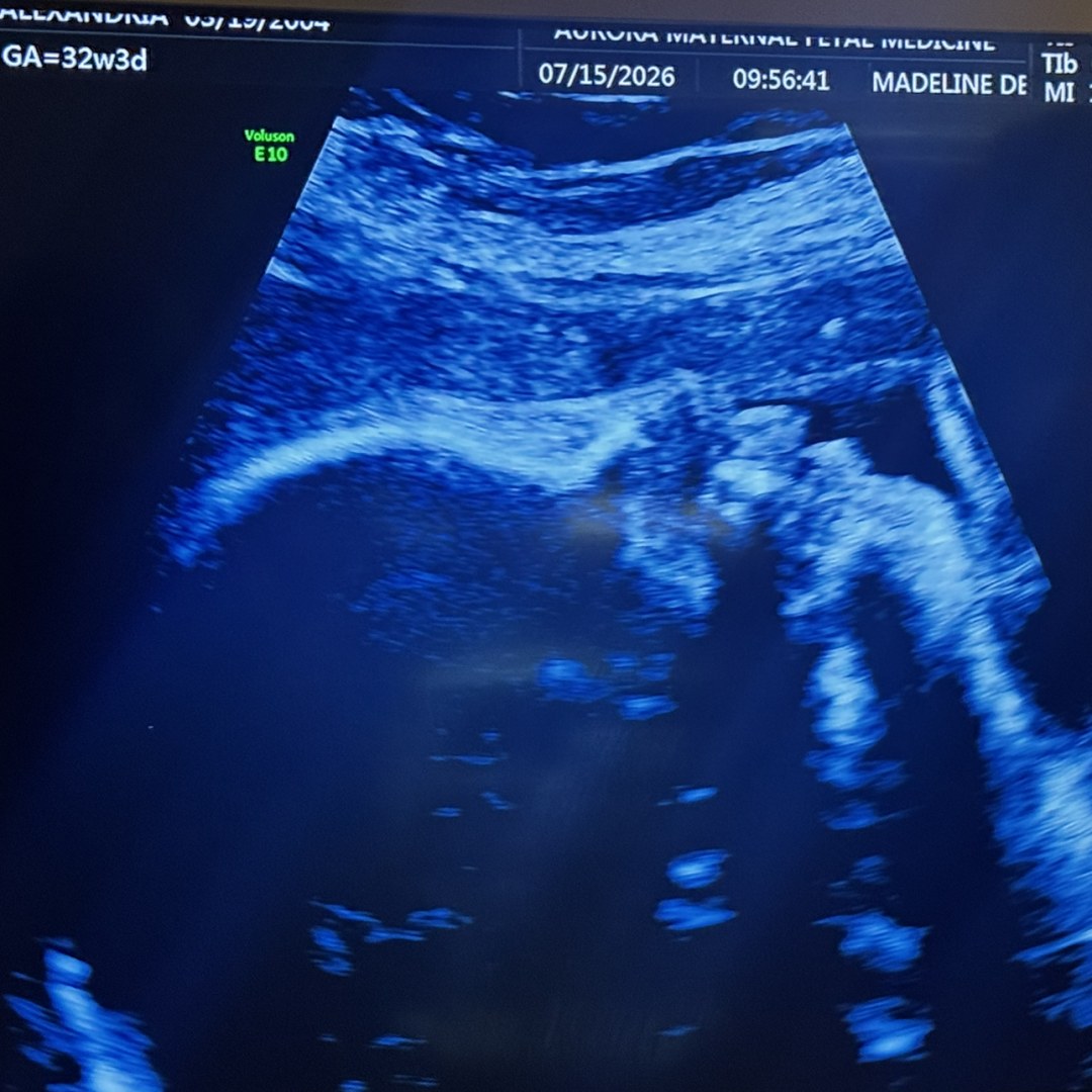 Photo shared by Alexandria for their Babylist baby registry.