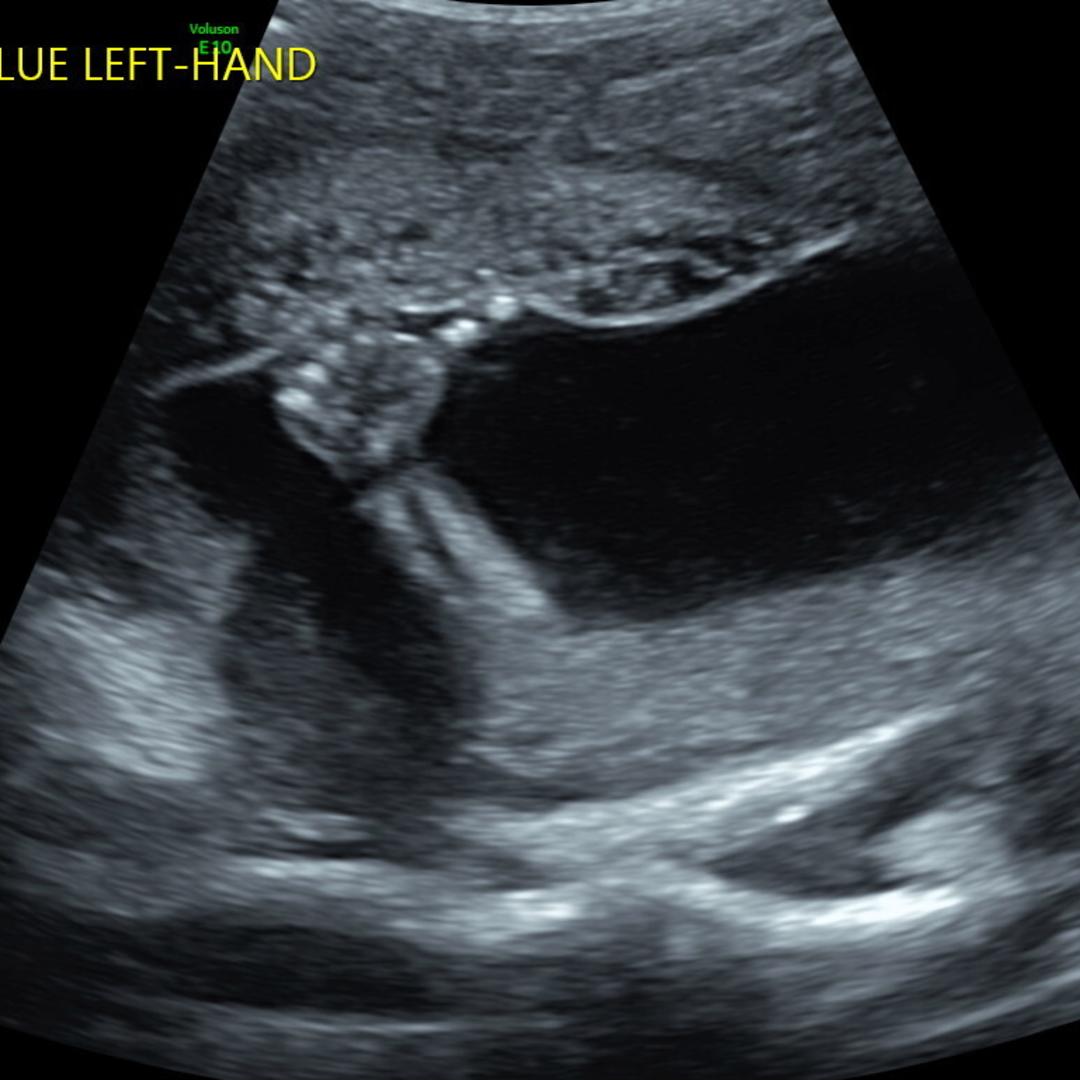 Photo shared by Addie for their Babylist baby registry.
