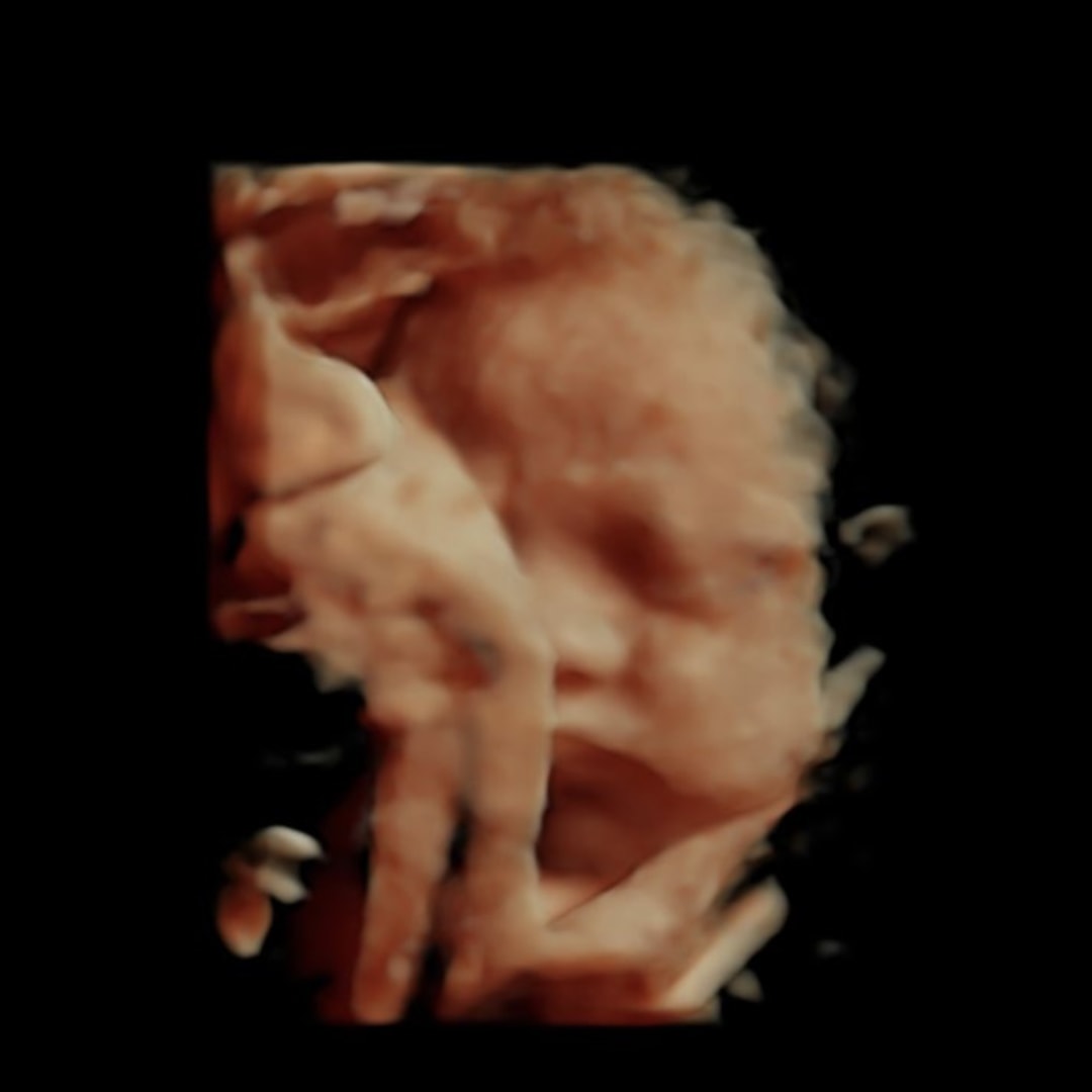 Photo shared by Ryleigh for their Babylist baby registry.