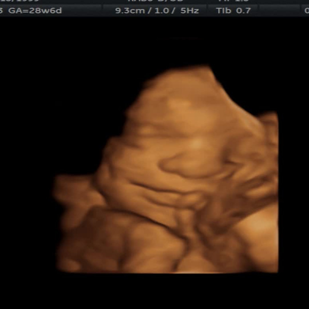 Photo shared by Ann for their Babylist baby registry.