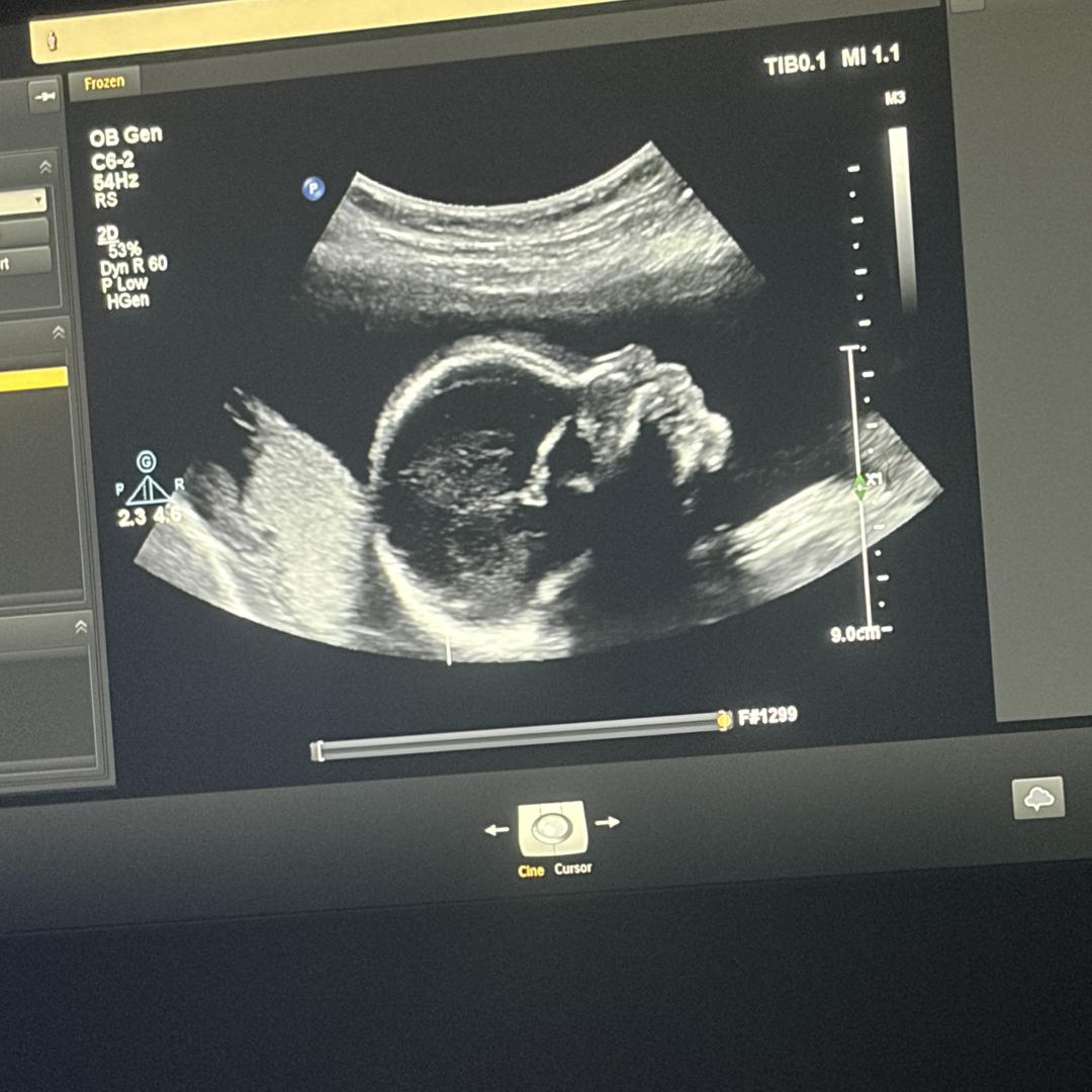 Photo shared by Bailey for their Babylist baby registry.