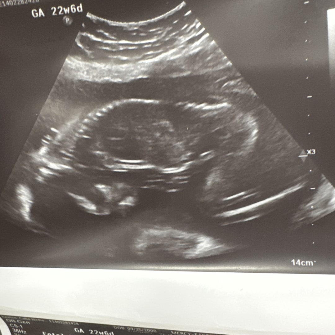 Photo shared by Callie for their Babylist baby registry.