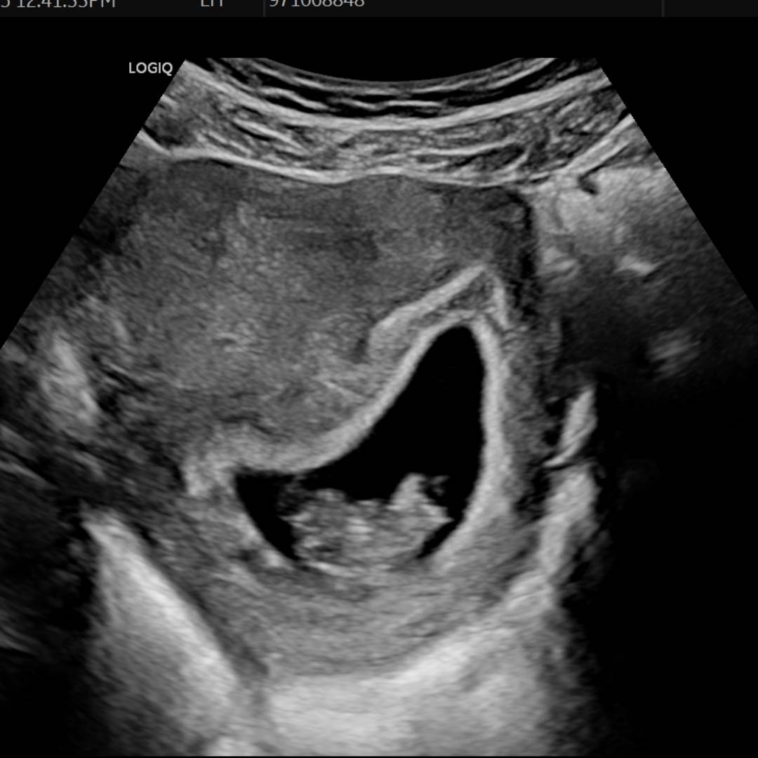 Photo shared by Jessica for their Babylist baby registry.
